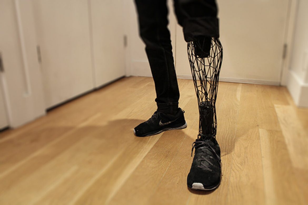 Know about how prosthetics can help you